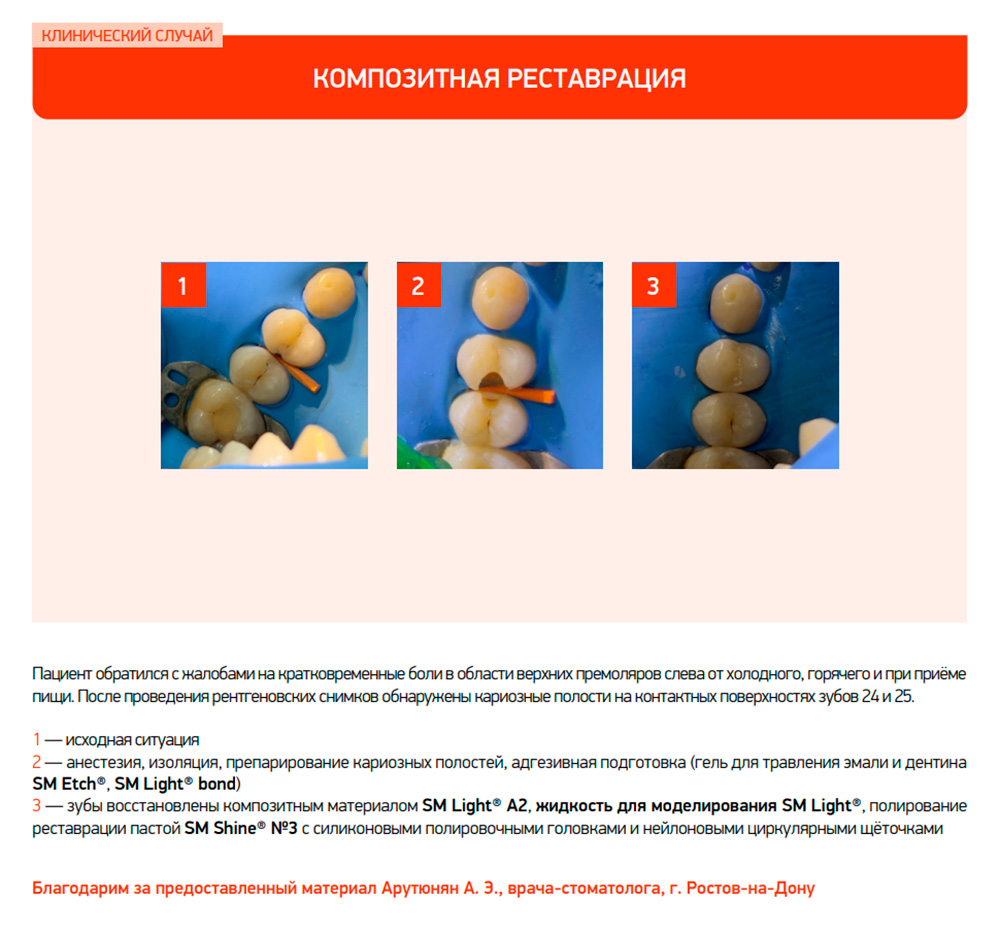 СМ_Этч_клинсл02